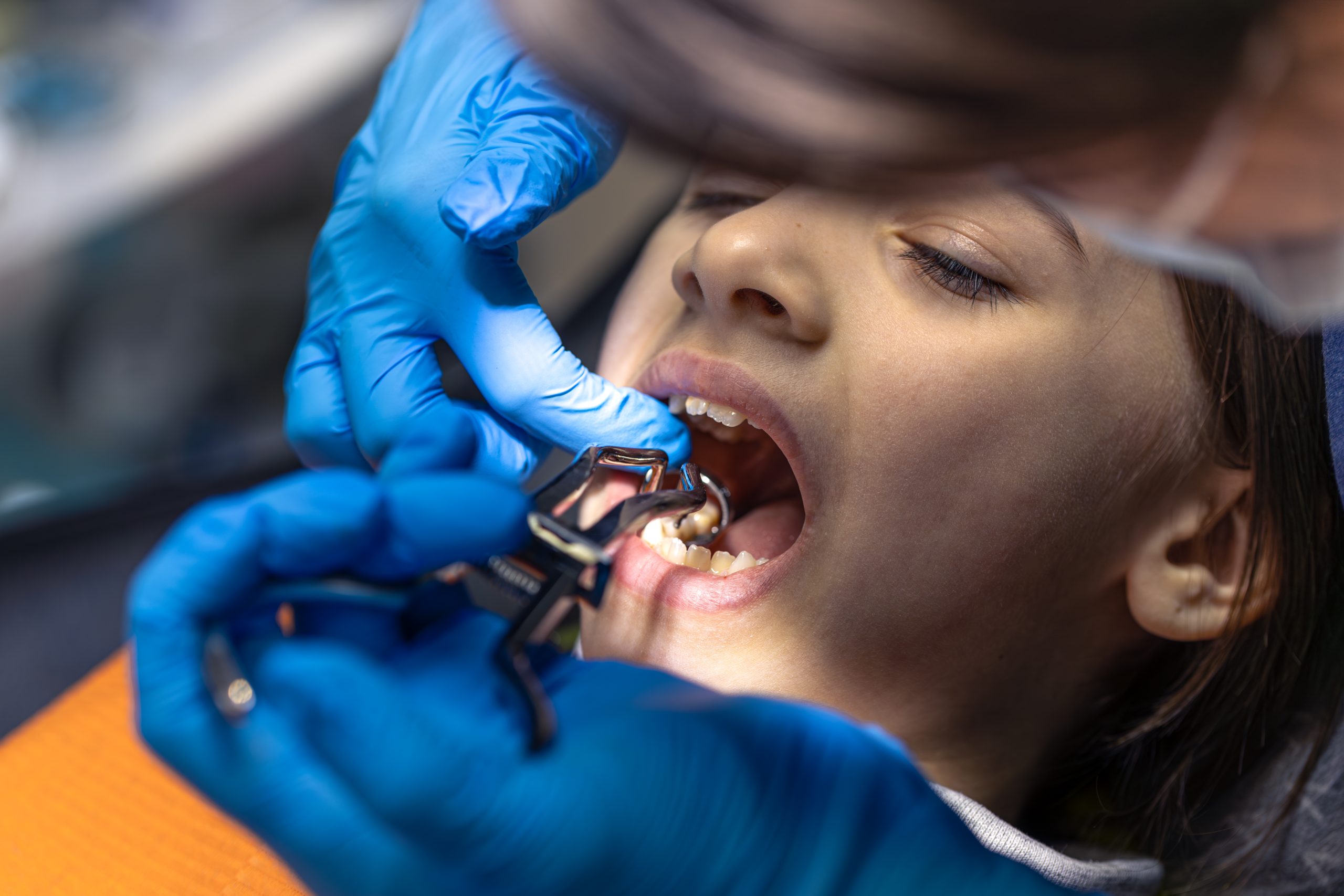 a wman is getting dental treatment.