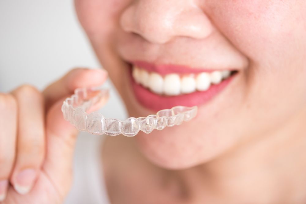 invisalign treatment journey